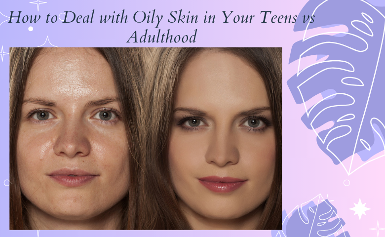 Oily Skin in Your Teens vs Adulthood